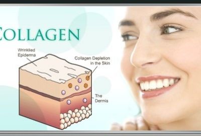 5 Nguyên nhân làm giảm sản xuất Collagen trong cơ thể